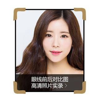 术后恢复