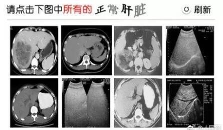 截图20170925165444