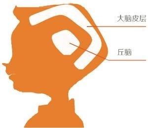 脑电生物反馈训练