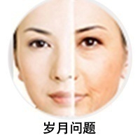 肌肤松弛、下垂