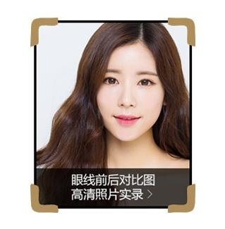 术后恢复