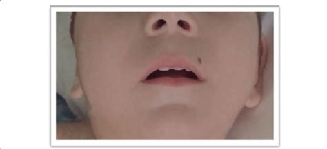 【3-6岁看图说话口才课】大嘴小嘴学说话