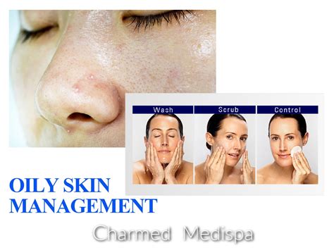 西安皮肤管理培训推荐