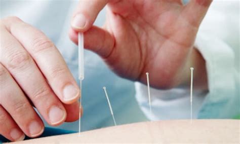 定西中医产后康复培训,正规产康培训