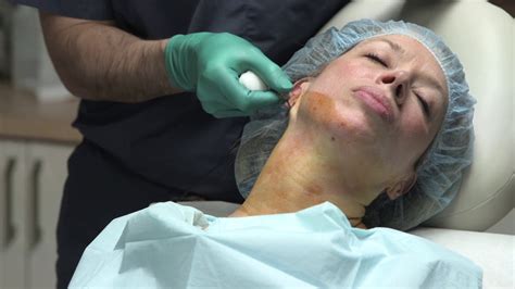 成都天鹅颈紧致手法培训