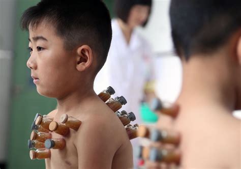 贵阳拔罐疗法技能实战学习机构推荐