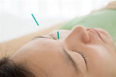 贵阳少儿针灸专业技能一对一培训机构