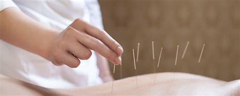 贵阳小儿针灸课程价格大概多少