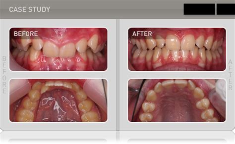 贵阳青少年不良行为习惯矫正机构