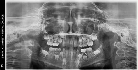 石狮自闭症儿童康复机构推荐