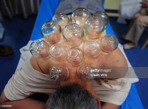 合肥中医推拿培训辅导哪家好