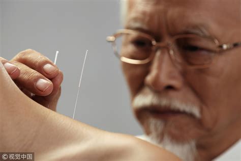 深圳培训中医针灸师费用多少_针灸课程