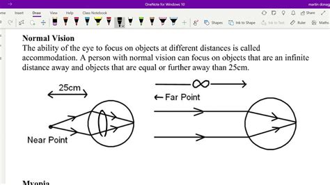 高级视力矫正保健全科班