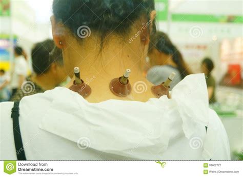 深圳保健按摩课程培训