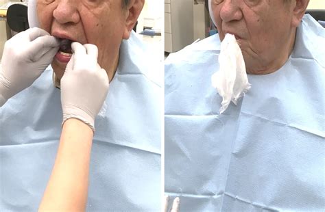 福州口肌障碍康复课程