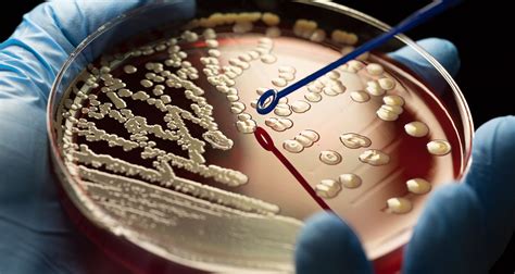 美国南加州大学分子微生物学与免疫学专业解析