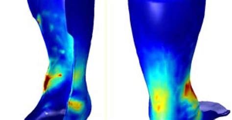 假肢与矫形器设计与制造