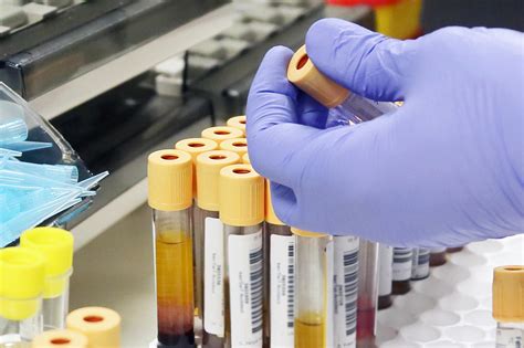 药品质量检测技术