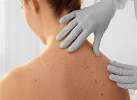 皮膚病與性病高級進(jìn)修班