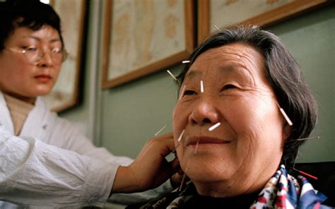 中医针灸培训，医院针灸科教授临床教学