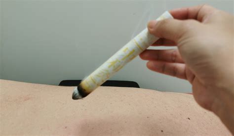 三伏灸、三九灸中医外治疗法膏方膏药班
