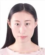 袁风婷